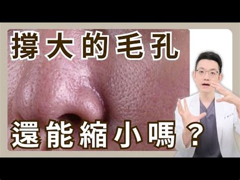 臉頰長白毛|臉長白毛位置暗示何事？